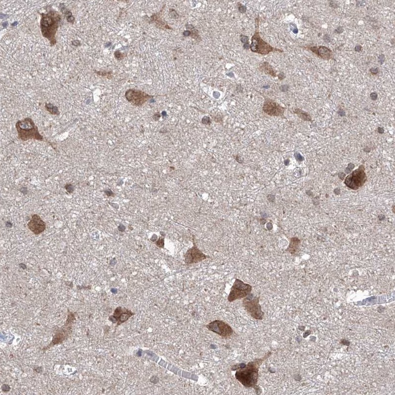 Atlas Antibodies Anti-LURAP1 Antibody