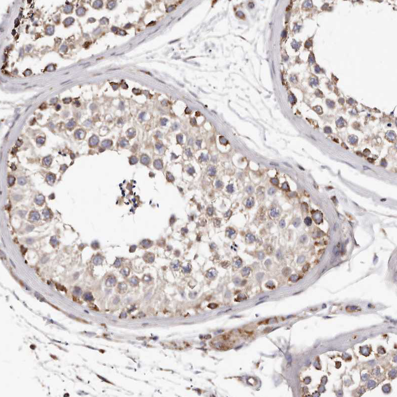 Atlas Antibodies Anti-LUZP1 Antibody