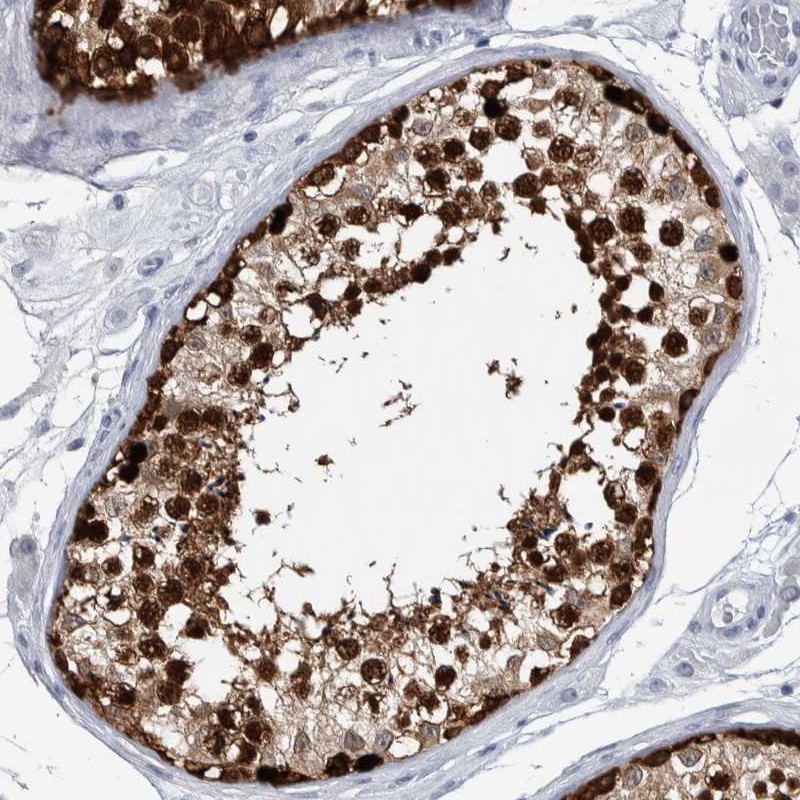 Atlas Antibodies Anti-LURAP1L Antibody