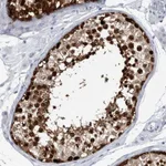 Atlas Antibodies Anti-LURAP1L Antibody
