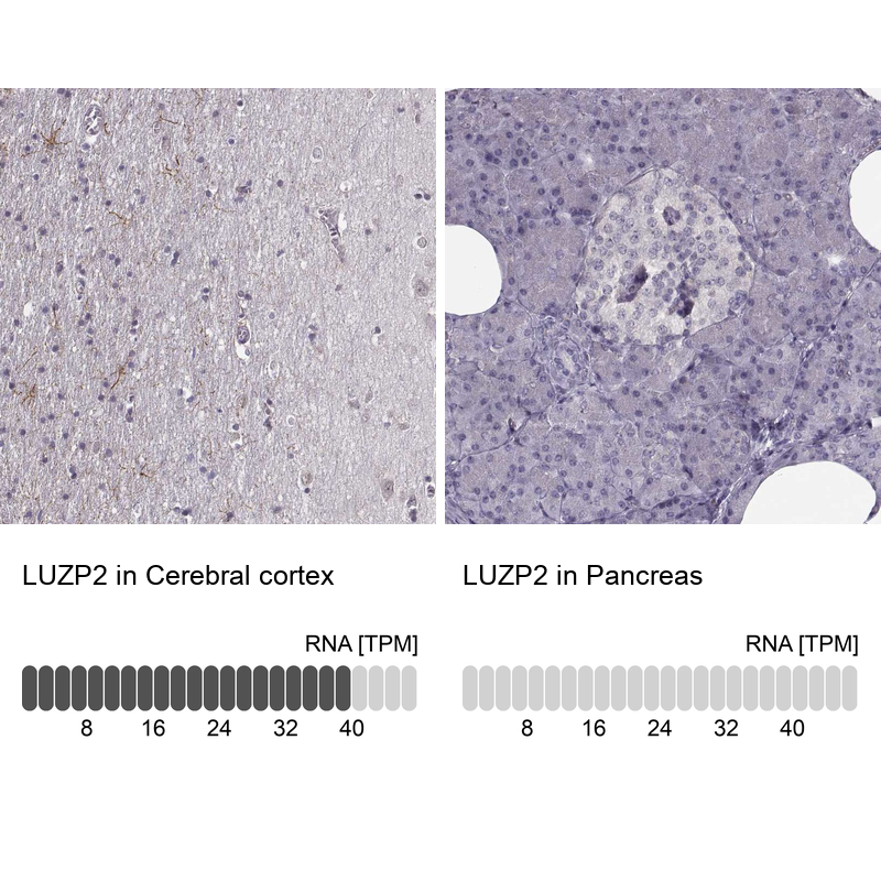 Atlas Antibodies Anti-LUZP2 Antibody