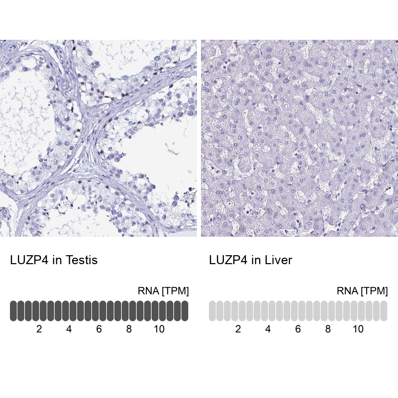 Atlas Antibodies Anti-LUZP4 Antibody