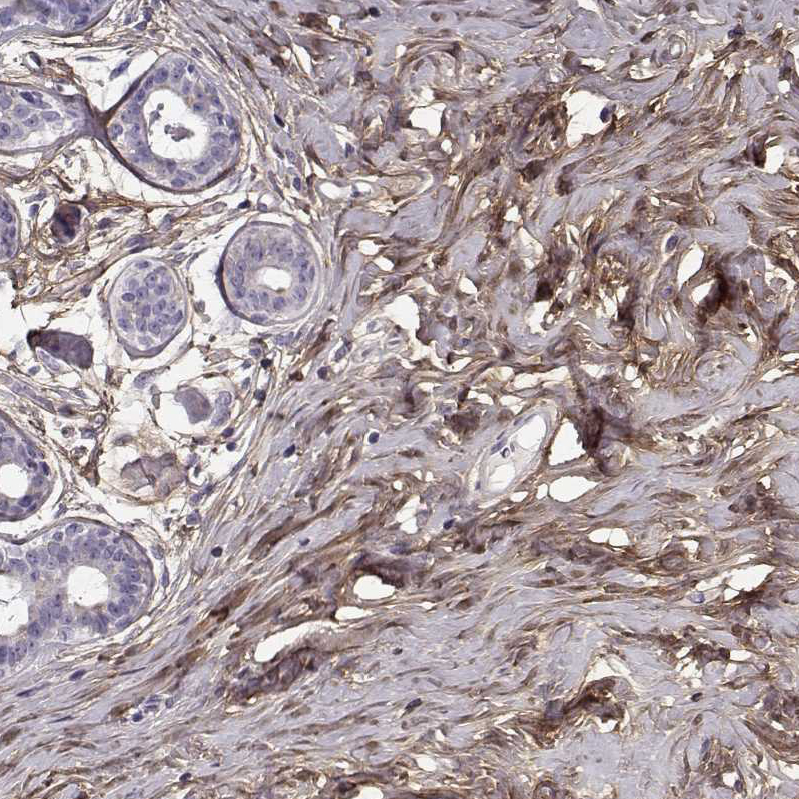 Atlas Antibodies Anti-LUM Antibody