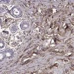 Atlas Antibodies Anti-LUM Antibody