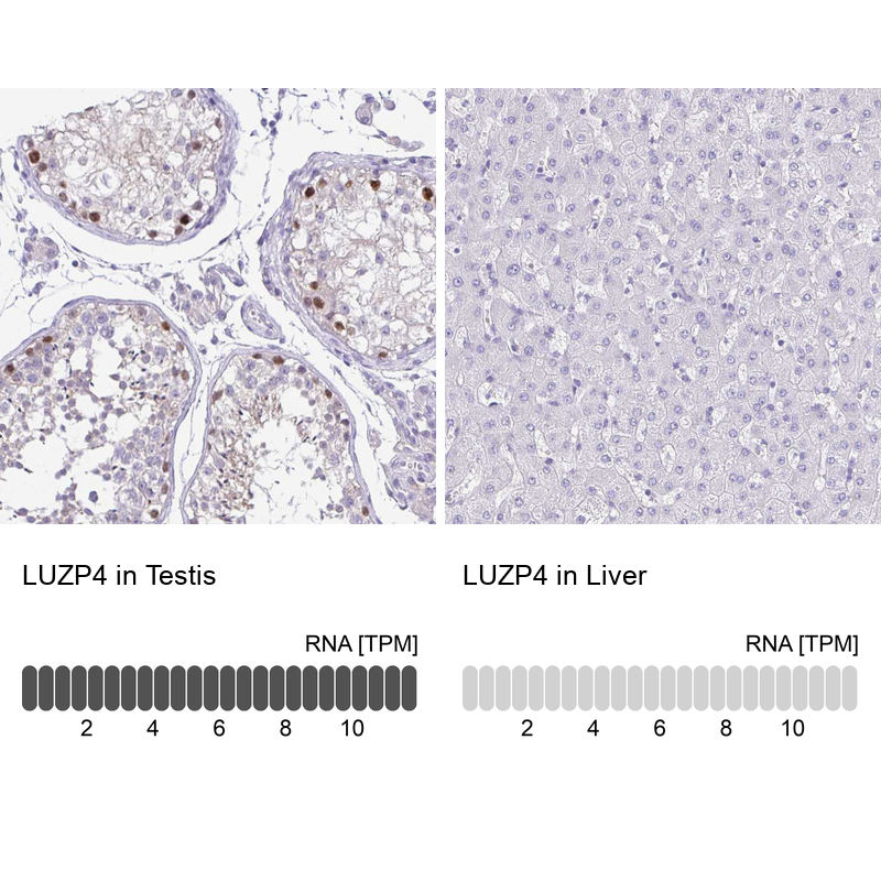 Atlas Antibodies Anti-LUZP4 Antibody