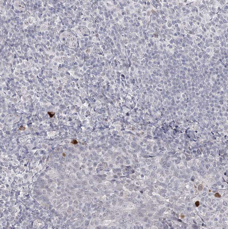 Atlas Antibodies Anti-LY6G5C Antibody
