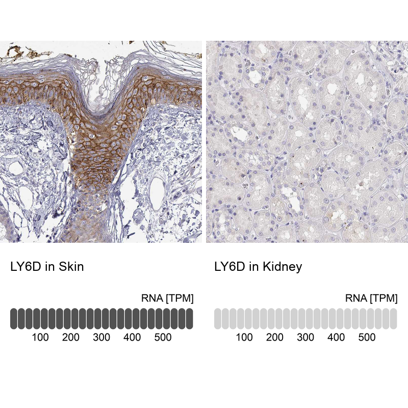 Atlas Antibodies Anti-LY6D Antibody