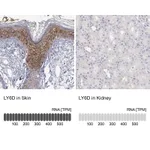 Atlas Antibodies Anti-LY6D Antibody