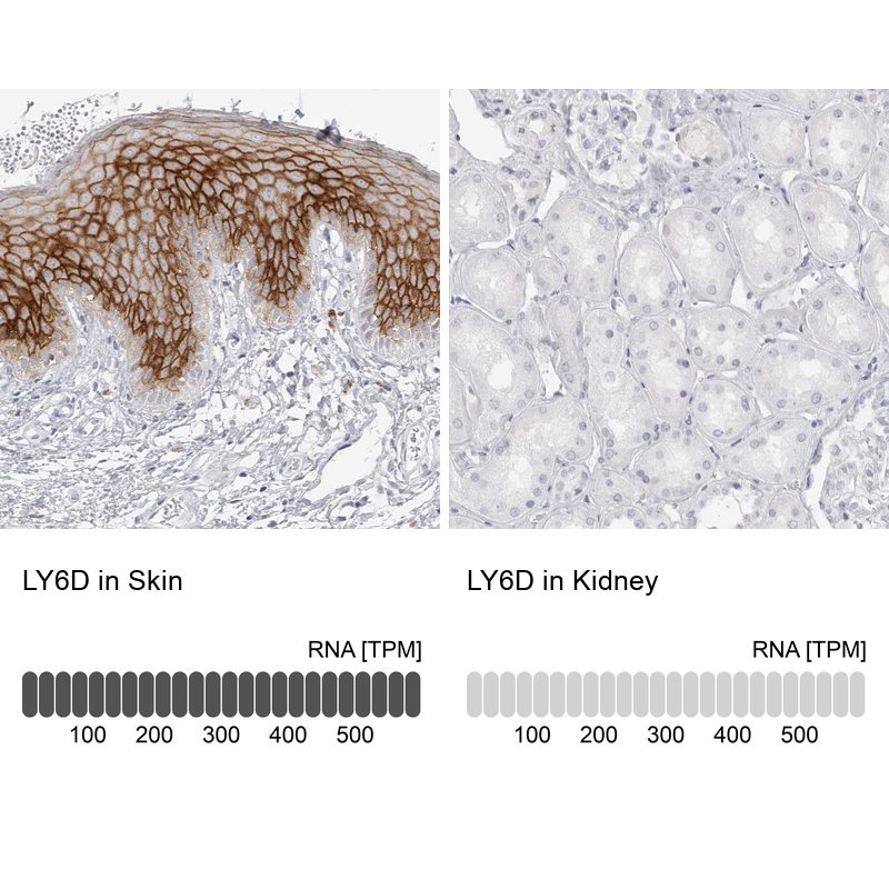 Atlas Antibodies Anti-LY6D Antibody