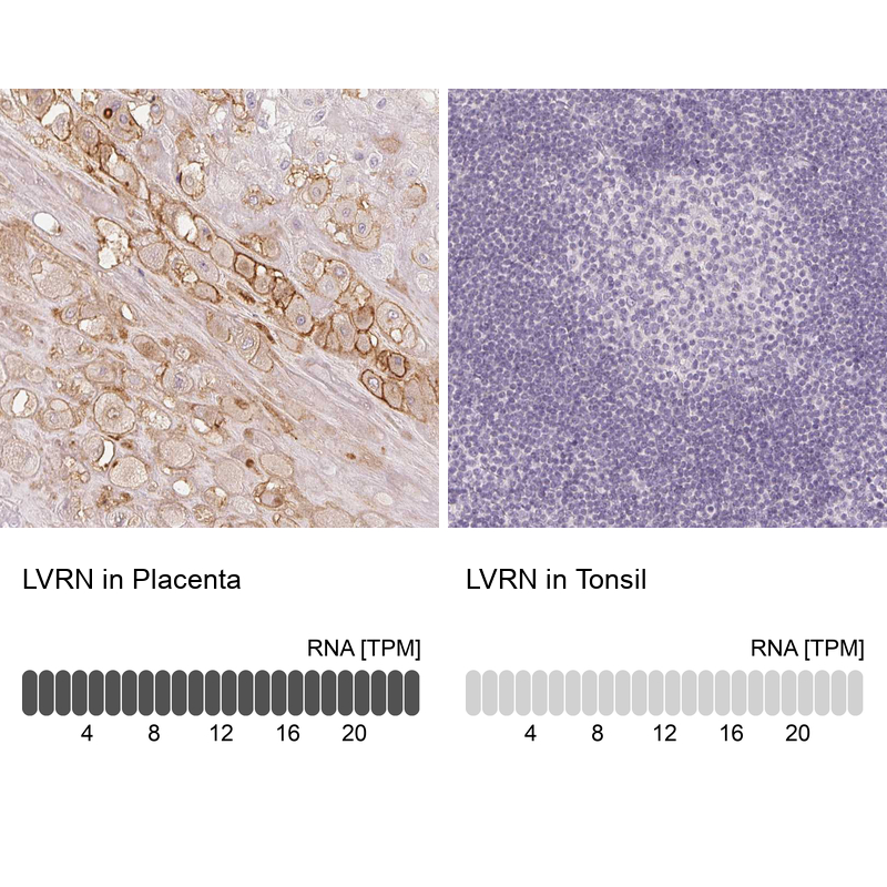 Atlas Antibodies Anti-LVRN Antibody