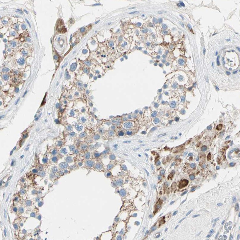Atlas Antibodies Anti-LY6G6F Antibody