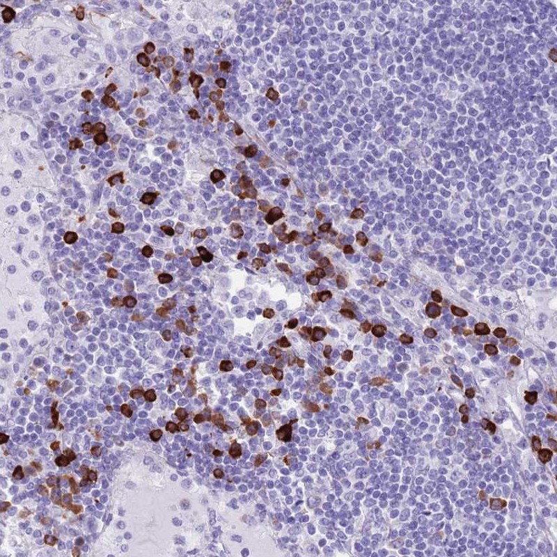 Atlas Antibodies Anti-LY6G5B Antibody