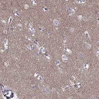 Atlas Antibodies Anti-LY6H Antibody