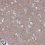 Atlas Antibodies Anti-LY6H Antibody