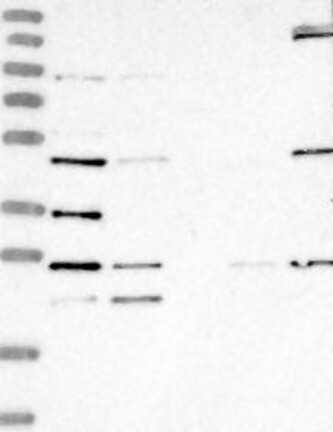 Atlas Antibodies Anti-LYAR Antibody