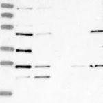 Atlas Antibodies Anti-LYAR Antibody