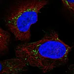 Atlas Antibodies Anti-LY96 Antibody