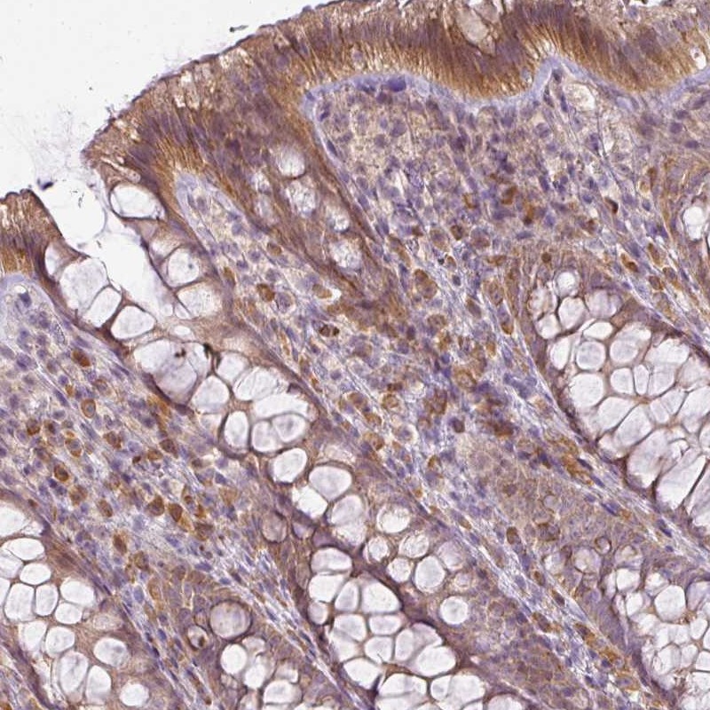 Atlas Antibodies Anti-LY75 Antibody