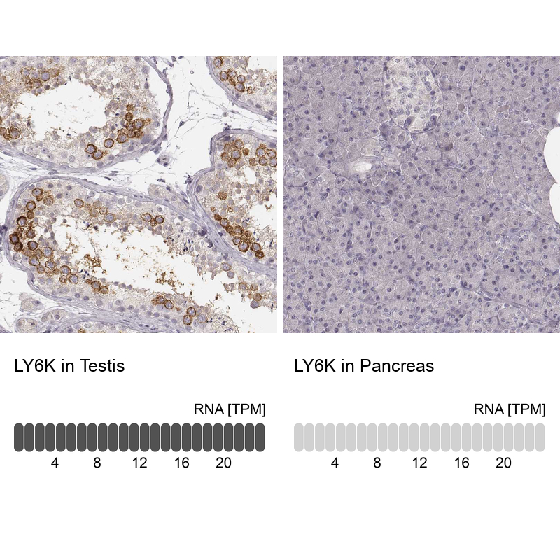 Atlas Antibodies Anti-LY6K Antibody