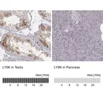 Atlas Antibodies Anti-LY6K Antibody