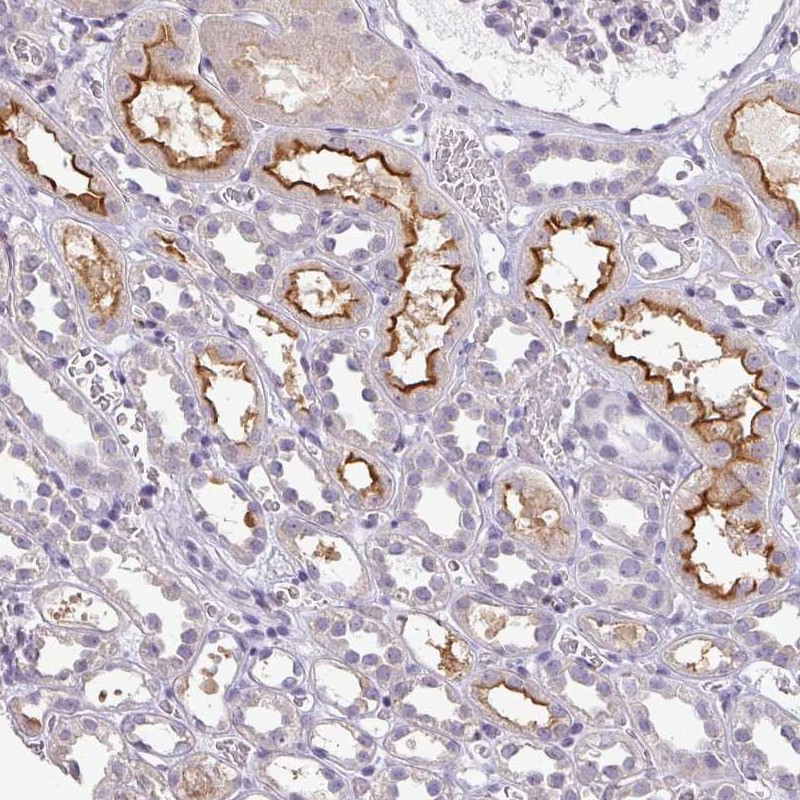 Atlas Antibodies Anti-LY9 Antibody