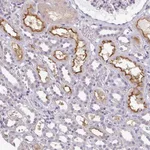 Atlas Antibodies Anti-LY9 Antibody