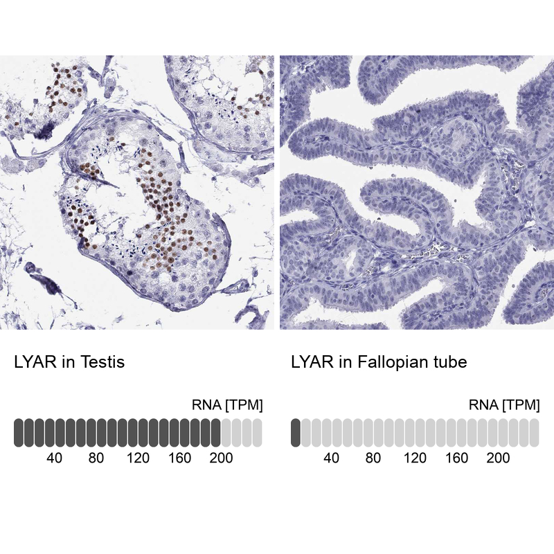 Atlas Antibodies Anti-LYAR Antibody