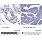 Atlas Antibodies Anti-LYAR Antibody