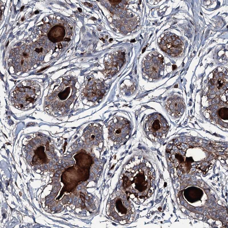 Atlas Antibodies Anti-LYG2 Antibody