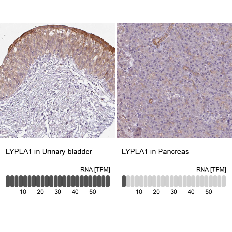 Atlas Antibodies Anti-LYPLA1 Antibody