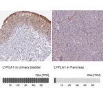 Atlas Antibodies Anti-LYPLA1 Antibody