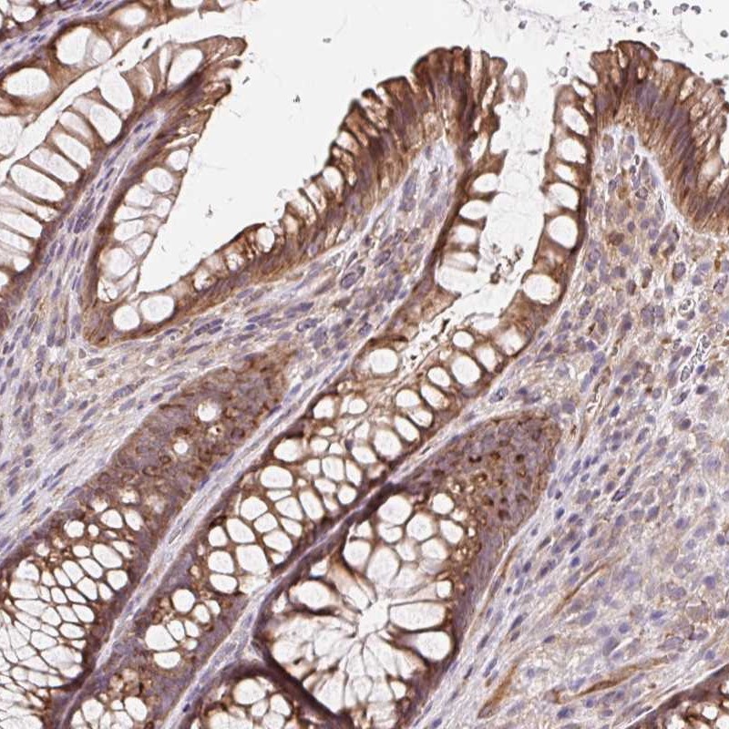 Atlas Antibodies Anti-LYPD5 Antibody