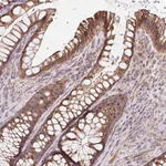 Atlas Antibodies Anti-LYPD5 Antibody