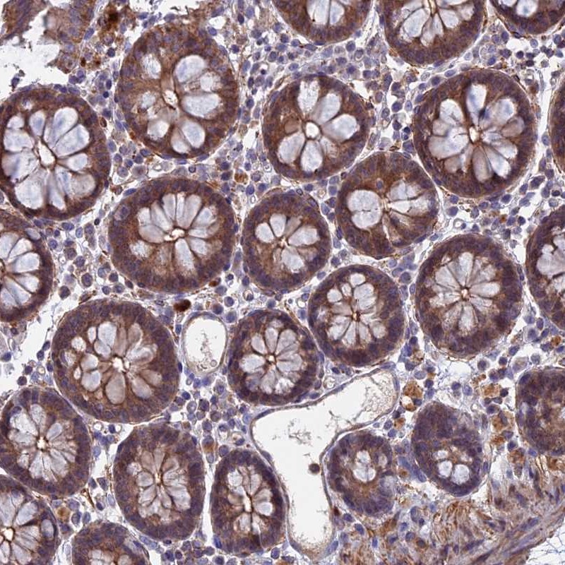 Atlas Antibodies Anti-LYPD5 Antibody
