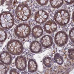 Atlas Antibodies Anti-LYPD5 Antibody
