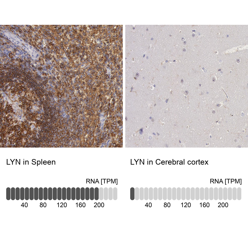 Atlas Antibodies Anti-LYN Antibody