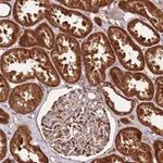 Atlas Antibodies Anti-LYPLAL1 Antibody