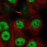 Atlas Antibodies Anti-LYRM1 Antibody