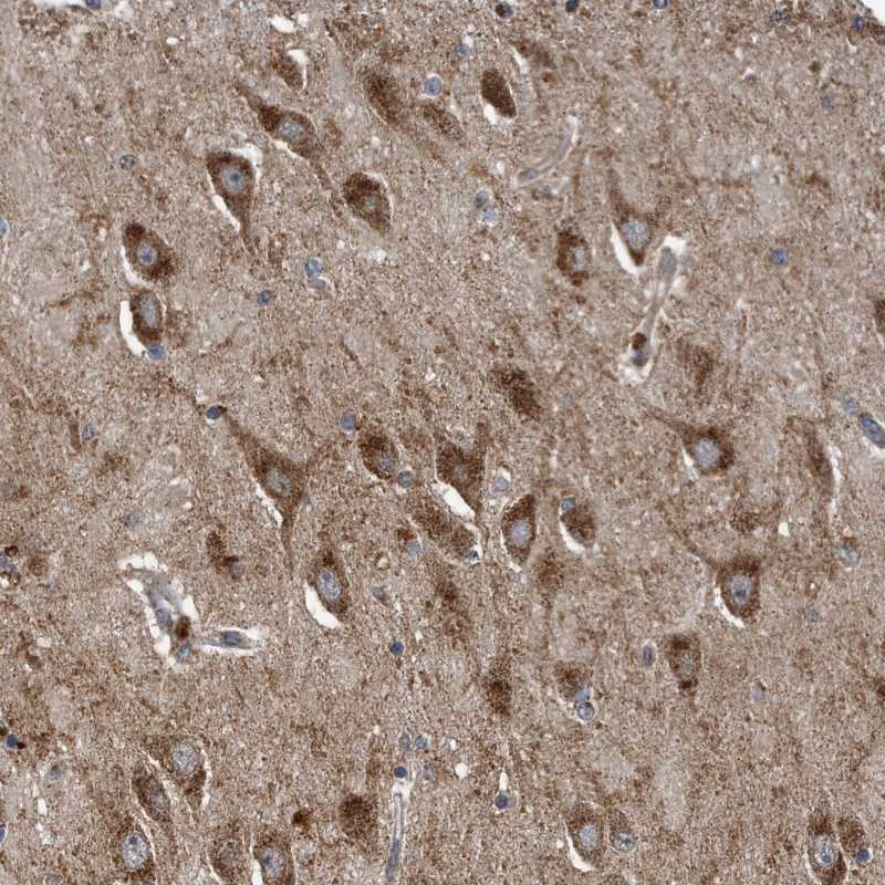 Atlas Antibodies Anti-LYRM4 Antibody