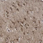 Atlas Antibodies Anti-LYRM4 Antibody