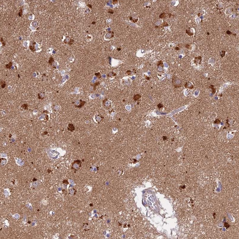 Atlas Antibodies Anti-LYSMD2 Antibody