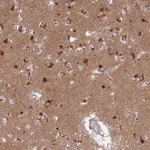 Atlas Antibodies Anti-LYSMD2 Antibody