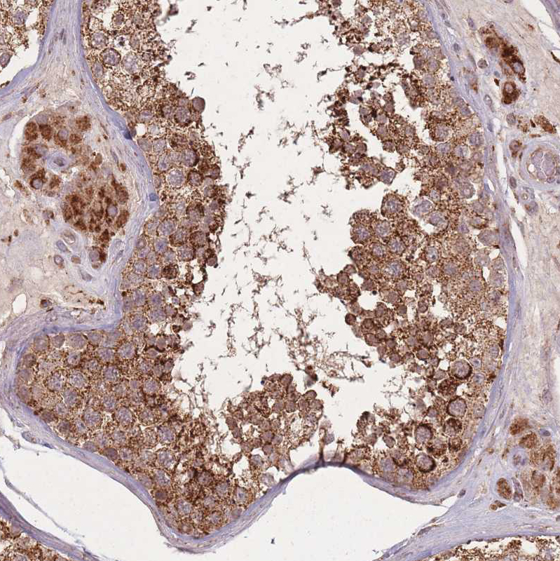 Atlas Antibodies Anti-LYRM7 Antibody