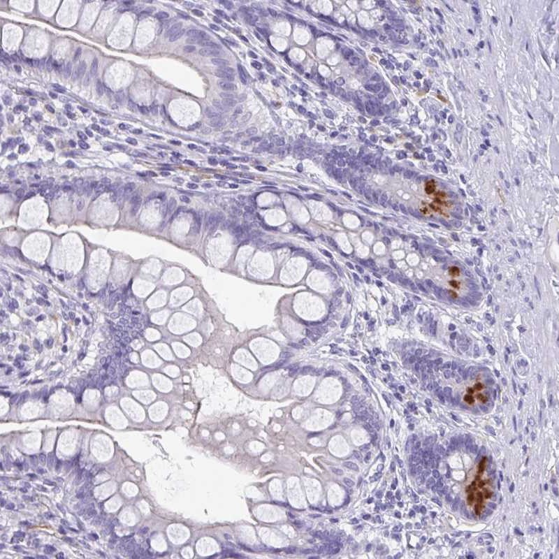 Atlas Antibodies Anti-LYRM2 Antibody