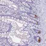 Atlas Antibodies Anti-LYRM2 Antibody