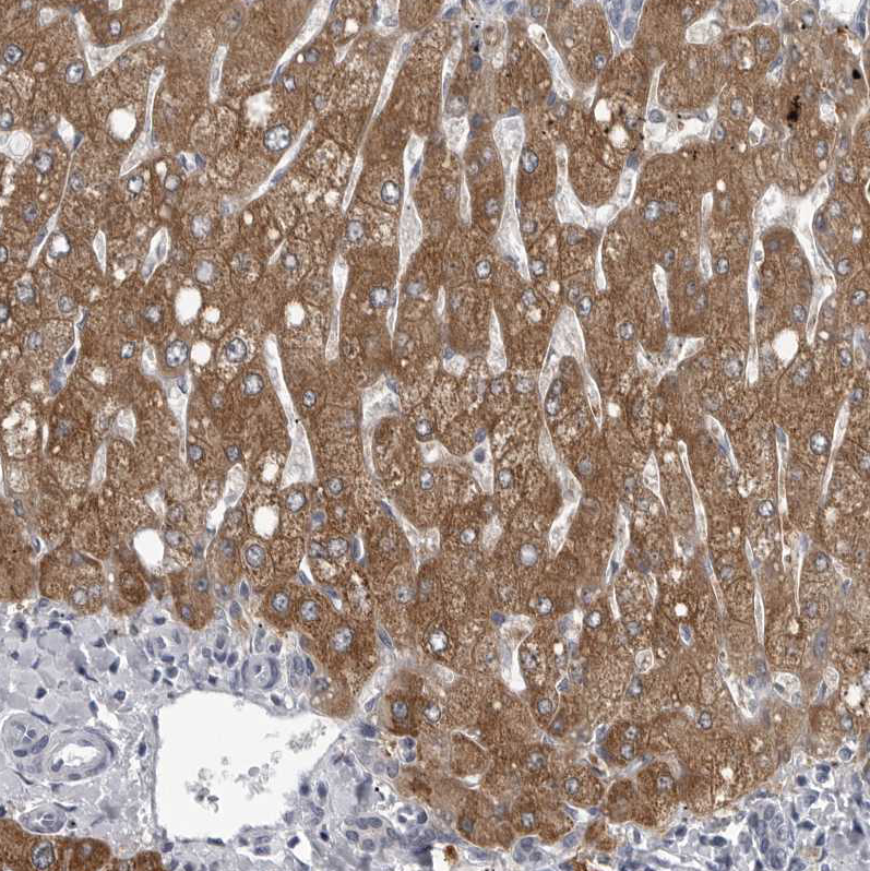 Atlas Antibodies Anti-LYSMD1 Antibody