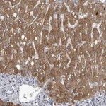 Atlas Antibodies Anti-LYSMD1 Antibody