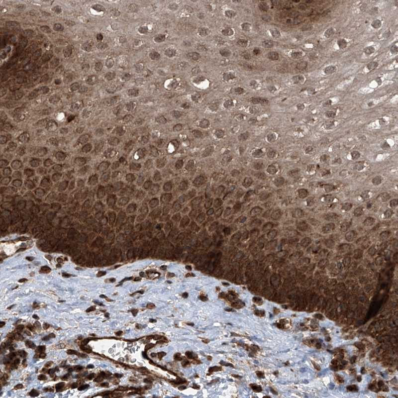 Atlas Antibodies Anti-LYSMD4 Antibody