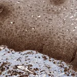 Atlas Antibodies Anti-LYSMD4 Antibody