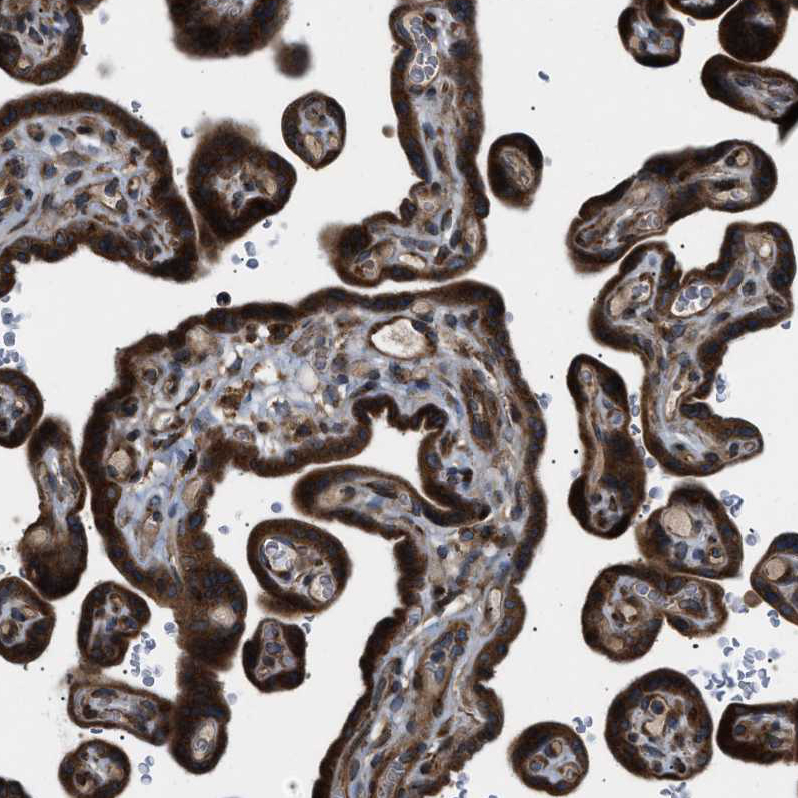 Atlas Antibodies Anti-LYSMD3 Antibody